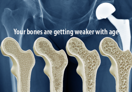 SPECIAL OFFER – Densitometry – Check Your Bone Health